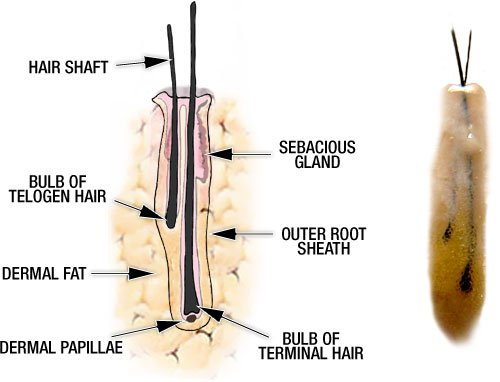 Follicular Unit Grafts