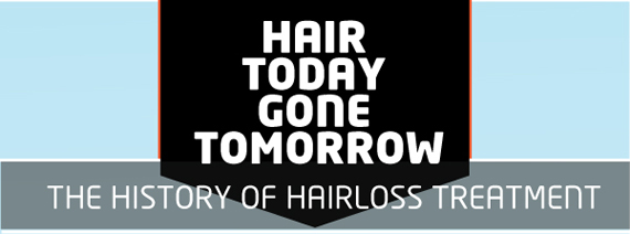 Hair Today Gone Tomorrow