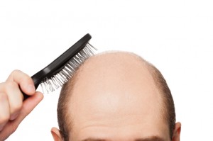 iStock_000020070127Small-300x199Dihydrotestosterone is a chemical we have referred to in several of our articles. Commonly abbreviated as DHT, this chemical is a male hormone, converted from testosterone. High levels of it are the main cause of hair loss in men and women. However, there is more to it than just that.  DHT Love Before we get into why an abundance of DHT is bad for those of us who want to keep our hair, there are actually DHT enthusiasts out there.  As we all have come to know, there are two populations among hair loss: those who are reluctant, and those that don’t care. A percentage of the latter makes up the enthusiasts. According to some possibly biased research, DHT is a “stronger” form of testosterone.  DHT is synthesized from testosterone daily, in both men and women. 5-10% of a male’s testosterone will be converted until their genetics or glands cause an increase of testosterone for conversion. In both sexes, a higher conversion rate begins around the time of puberty, however there is a large defining feature of it in males. DHT is what causes the formation of the male genitalia during fetal development. A lack of it throughout ontogeny will cause underdeveloped genitalia, as well as an underdeveloped prostate.  Knowing how important DHT is to the development of the male body, it is clear why many men don’t take it for granted. Those that embrace DHT have done their share of research on its benefits, and without a guess, you can find a few body building articles on it. Heralded as “3 or more times as powerful of regular testosterone,” DHT is cherished by those looking to build strength and muscle. DHT is known to play a role in not only sexual development, but also the enhancement of muscles, and hair loss.  DHT vs Hair An abundance of DHT has a variety of effects on both genders of the human population. Although mainly active during and after puberty, it is present in the body prior to this. In terms of puberty, it controls the production of body hair, hormonal processes such as menstruation (women) and sperm production (men), amongst other hormonal changes. Later, if an abundance occurs, balding can arise.  Male Pattern Baldness, or MPB, is the corner stone result of an abundance of DHT. Hair follicles are sensitized when presented to DHT, causing them to shrink and having a shorter lifespan as opposed to the normal hair growth cycle of several years.  Hair has three phases in its life cycle: growing, resting, and dying. During MPB, the growing phase fades as the resting phase increases in duration.  Since baldness happens mostly on the scalp, this is the main area scientists and researchers study when exploring the causes and cures for baldness.  The follicle bulb, containing the dermal papilla, is responsible for hair growth. It produces and divides the cells that make up hair follicles, and although hair is dead flesh, it is a result of the papilla getting nutrients from surrounding blood capillaries beneath the scalp.  When there is an abundance of DHT, it can block or implicate the absorption of nutrients to the dermal papilla. Once this happens, MPB or other forms of baldness can occur. Hair thinning is another effect that can result from DHT. As the hair follicle weakens and shrinks, the hair will also shrink and have a thin appearance. It can also fade in color, becoming lighter until hits the point of near transparency like the small furs that cover a majority of the human body.  There are several forms of baldness, not all caused by DHT:  -          MPB, sometimes referred to as Andogenetic Alopecia, is a form of baldness that miniaturizes hairs, and causes random areas of the scalp to become bald, tending to connect and create the “pattern” effect  -          Anagen Effluvium is rapid hair loss, usually caused by chemotherapy. The division of hair cells is halted, but as noted, an abundance of DHT can stop the dermal papilla from getting nutrition, thus also halting cell division  -          Telogen Effluvium is an extreme form of shedding, usually experienced as a result of trauma, infection, stress or surgery  -          Traction alopecia is hair loss from a constant pulling, such as intensive, excessive hair styling, braiding, etc  -          Regular balding, beginning with a receding hairline and a bald spot in the middle of the scalp  Although, not all baldness is caused by DHT, because DHT tends to affect the hair follicles and the division of hair cells beneath the scalp, many hair care and hair growth treatments target the scalp. Currently, the big chemical in the hair regrowth niche is Ketoconazole, an antifungal medication that cleanses the scalp of fungal infections, the fungi that causes dandruff, and DHT. These treatments are usually products such as shampoos and conditioners, but there are also topical solutions containing other chemicals.  DHT is a big problem when it comes to hair loss and baldness. However, it is also a main ingredient in the make-up of the human male. It’s not all bad, but just like most things, it’s best in moderation.