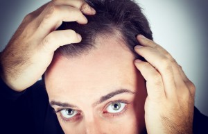 Dealing with Thinning Hair